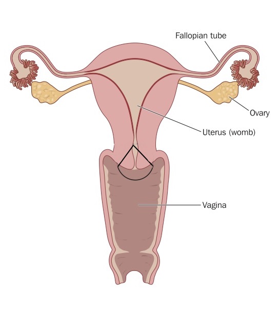 hpv magas kockázatú nach konisation weg