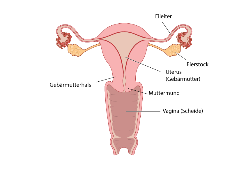 Gebärmutter/Uterus Eierstockkrebs
